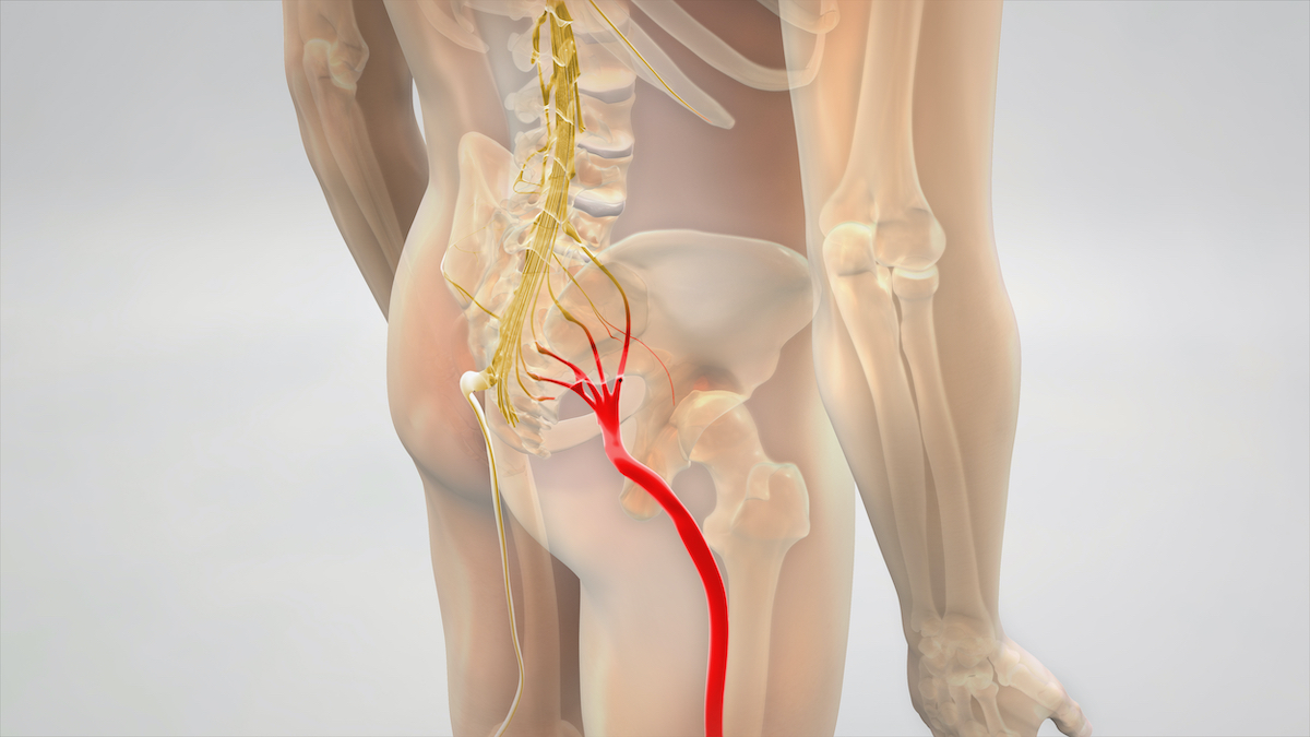 SCIATALGIA: cos’è? Quando rivolgersi all’osteopata